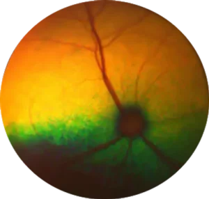 Feline Retina